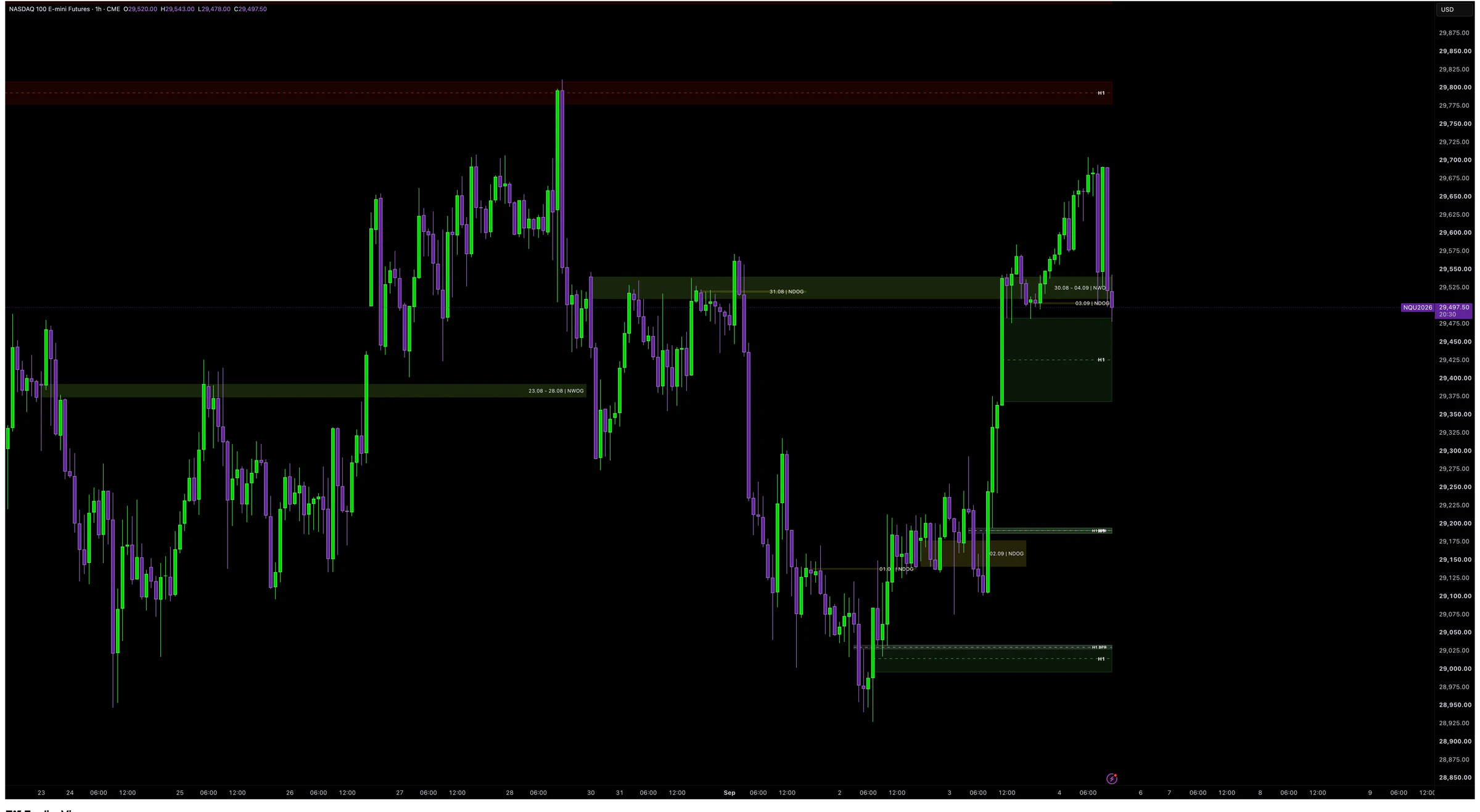 Trifecta imbalance analysis chart example